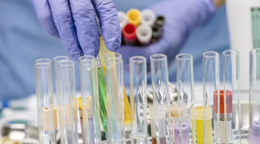 Scientist works with fluids in a laboratory research, conceptual image